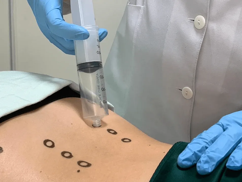 Atendimento de ozonioterapia com avaliação individual