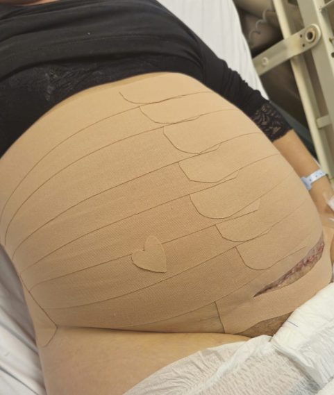 Acompanhamento de pós-parto