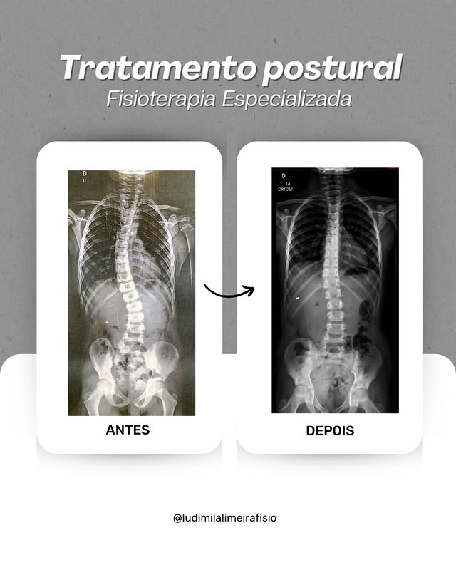 Avaliação e tratamento postural